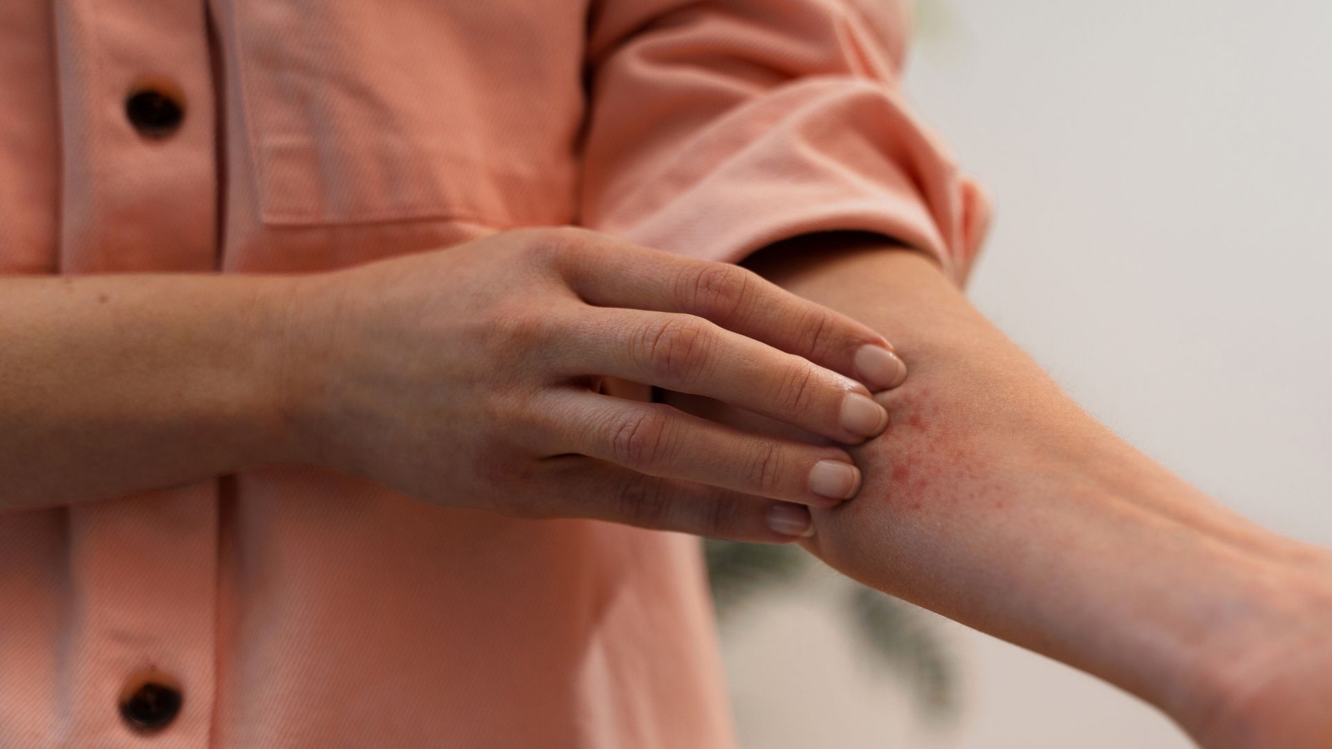 Which Doctor Offers Lupus Screening in San Antonio, TX? | Dr. Juan S. Pico