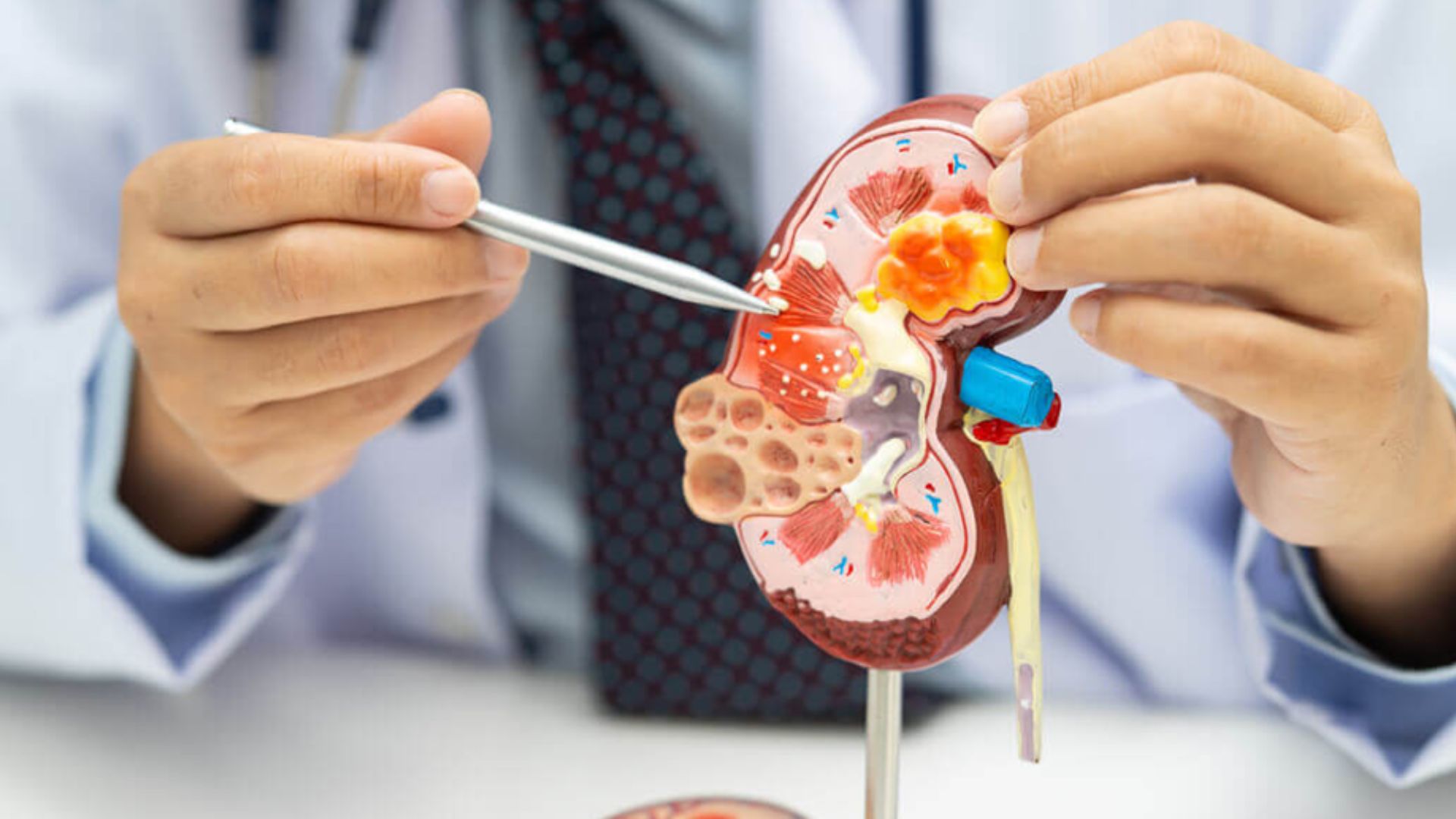 How Nephrology Services Support Patients with Chronic Kidney Disease