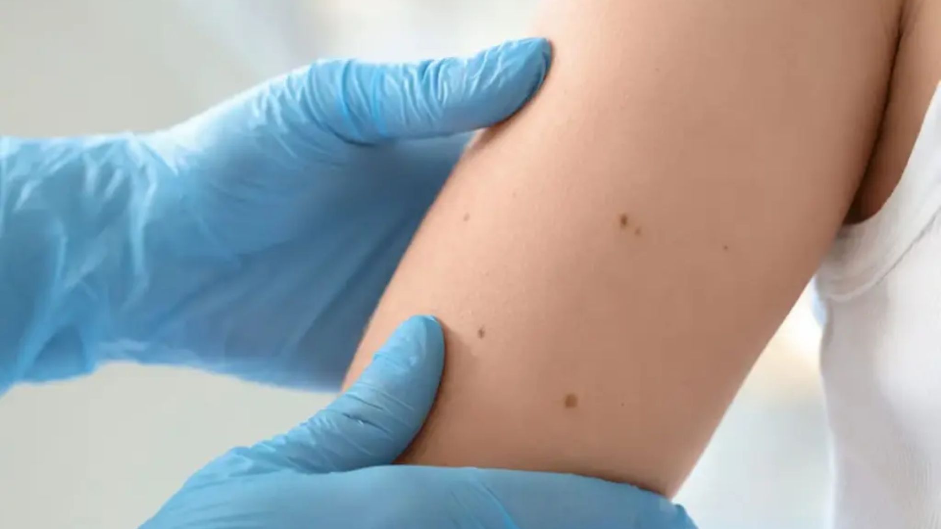 10 Signs Your Skin Needs Immediate Attention and Screening