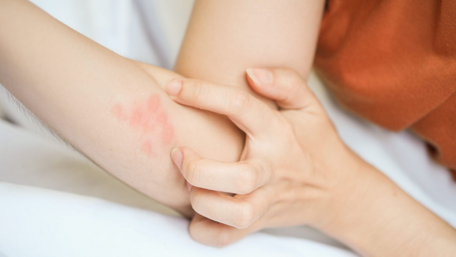 What Are the Warning Signs That a Rash Needs Immediate Medical Attention?