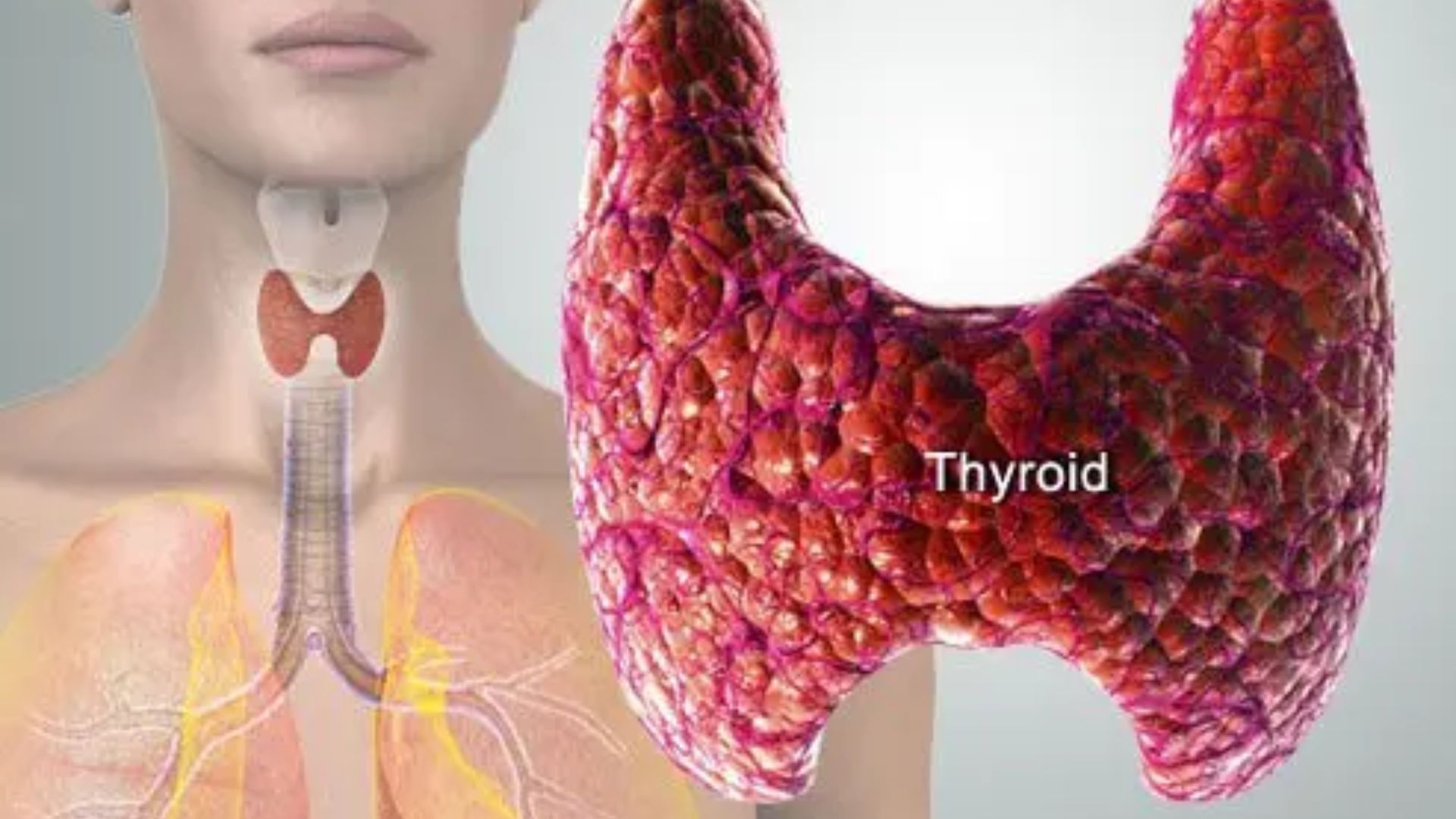 Understanding Thyroid Disorders: Symptoms and Treatment